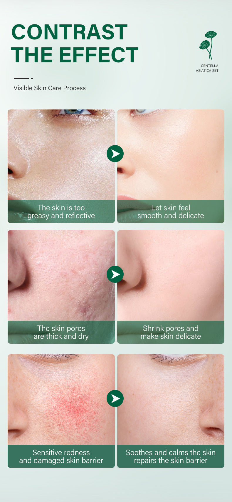 Snow Grass Facial Skincare Set – Hydrating & Brightening Cosmetics Kit