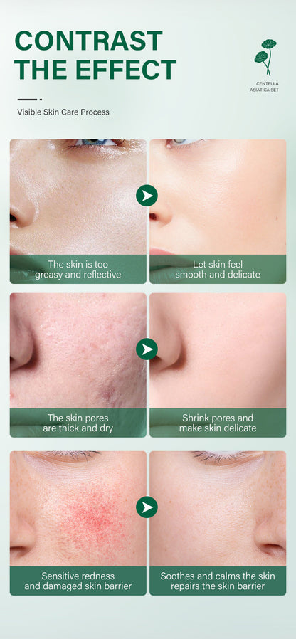 Snow Grass Facial Skincare Set – Hydrating & Brightening Cosmetics Kit