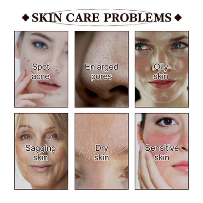 West&Month Black Tea Mask For Deep Cleansing, Refining Pores, Brightening Complexion, And Rejuvenating The Skin, A Type Of Application Mask